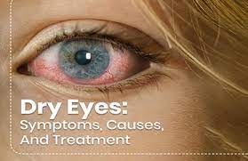 Dry Eyes Examination at Eye Clinic Of Central Optical in Karachi